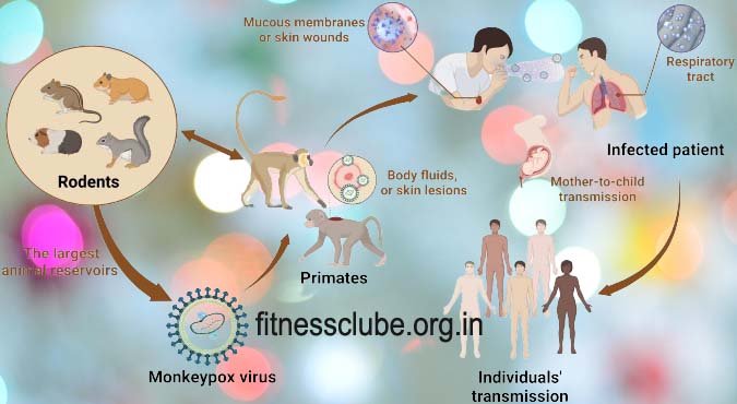 Symptoms of Monkey Pox Virus