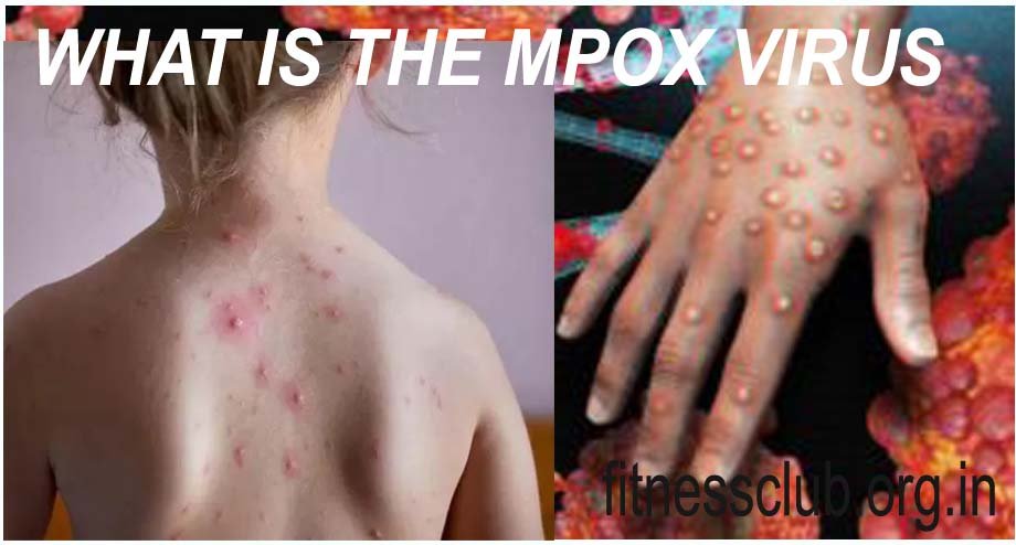 what is the mpox virus